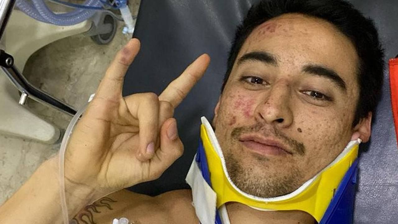 Cornejo, de líder al hospital: «Siento como si me hubiera pasado un tren por encima»